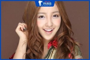 Niềng răng có phải nhổ răng khểnh không – 3 Trường hợp cụ thể