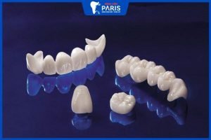 Răng sứ Cercon có tốt không – Giá bao nhiêu tiền