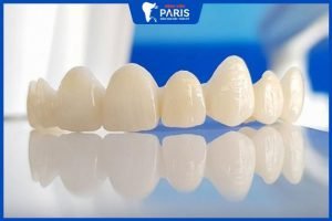 Răng sứ Emax có tốt không, 3 ưu điểm vượt trội về răng toàn sứ