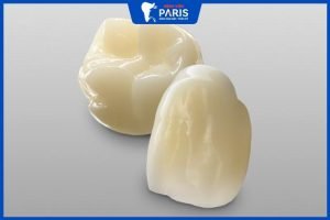 Răng sứ Lava có tốt không – 3 điểm khác biệt của dòng sứ Lava