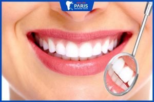Răng sứ Zirconia sử dụng được bao lâu – 5 yếu tố ảnh hưởng đến độ bền
