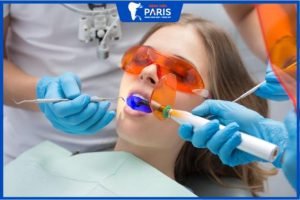 Tẩy trắng răng bằng laser có ê buốt không, ê buốt kéo dài do đâu?