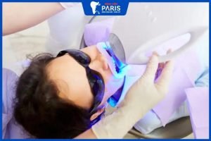 Giải đáp thắc mắc: Tẩy trắng răng Laser Whitening có tốt không