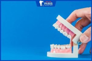 Trồng răng giả có đau không, 3 Phương pháp trồng răng phổ biến