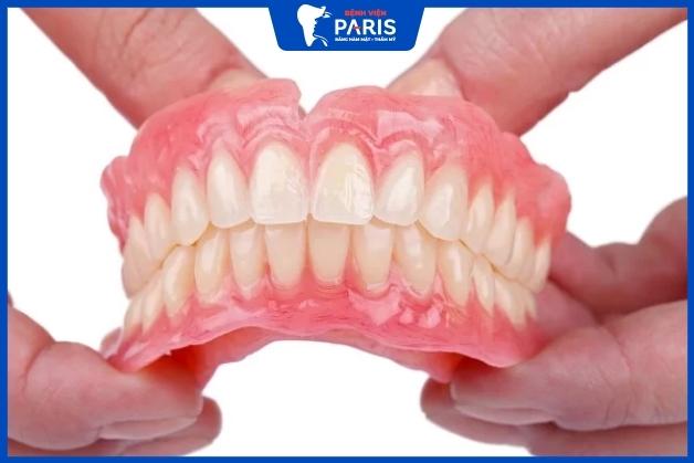 Trồng răng hàm mất bao nhiêu thời gian - Đối với hàm tháo lắp
