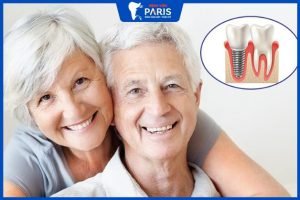 Trồng răng Implant cho người già: 5 Lợi ích khi trồng răng