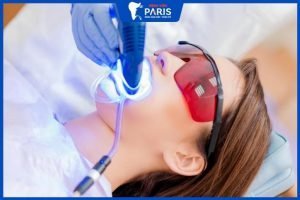 Công nghệ tẩy trắng răng Laser Whitening – 4 Ưu điểm cần biết