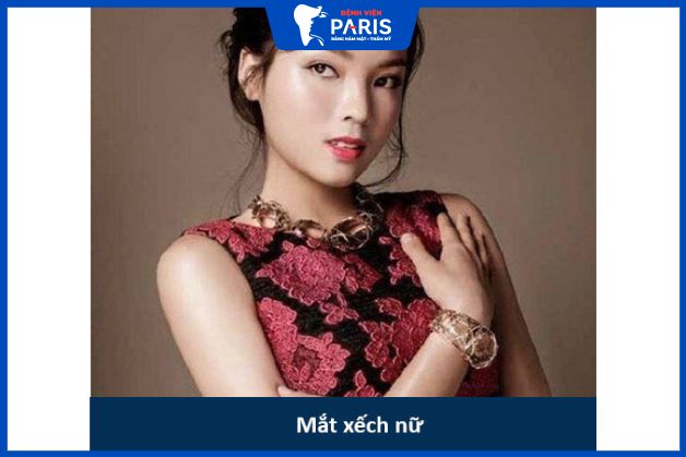 Khi đăng quang hoa hậu Việt Nam 2015 – Kỳ Duyên đã vấp phải nhiều chỉ trích về nhan sắc, trong đó bao gồm cả đôi mắt xếch mà cô sở hữu