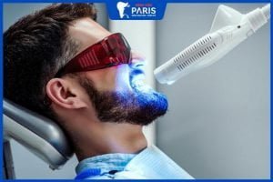 Tẩy trắng răng bằng laser có đau không? 3 nguyên nhân gây đau