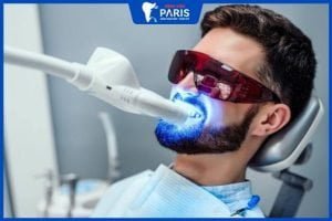 Tẩy trắng răng bằng phương pháp laser: Ưu điểm và chi phí