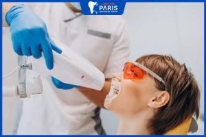 Tẩy trắng răng ở nha khoa có đau không – những lưu ý kèm theo