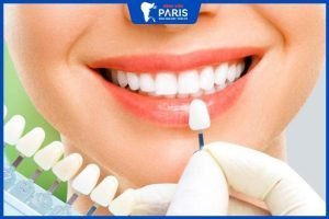 Tẩy trắng răng sứ được không? 5 lý do khiến răng sứ bị đổi màu