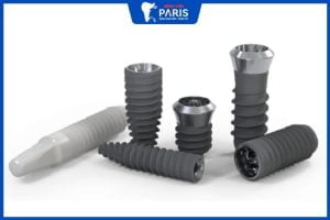 3 Loại Trụ Implant Hàn Quốc tốt nhất thị trường – Ưu điểm vượt trội