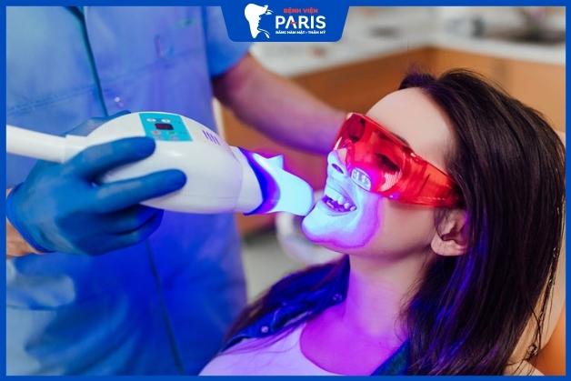 Ưu điểm tẩy trắng răng bằng phương pháp laser