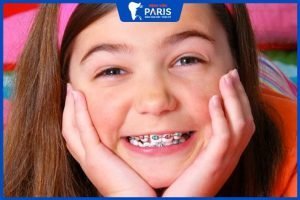 Giải đáp từ bác sĩ: Niềng răng cho trẻ em có ảnh hưởng gì không