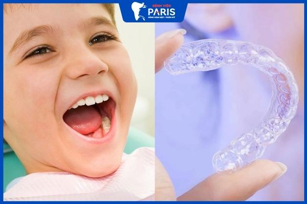 Tổng hợp các phương pháp niềng răng phù hợp với trẻ em