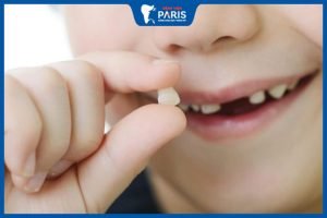 Cách nhổ răng không đau – Hướng dẫn chi tiết nhất dành cho bạn