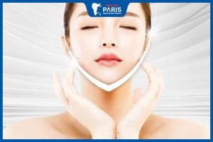 Độn cằm có được vĩnh viễn không? Chi phí thực hiện độn cằm