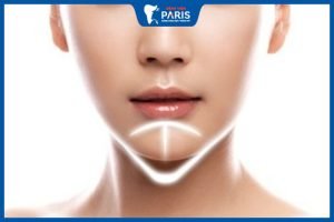 Góc giải đáp thắc mắc: Phẫu thuật độn cằm có nguy hiểm không