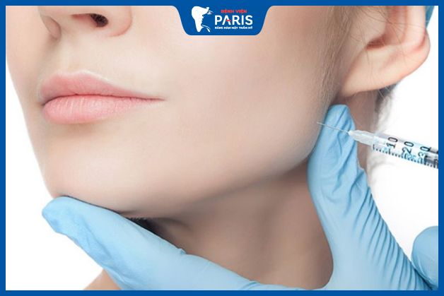 Bạn có thể tiêm lại botox sau khoảng 6 - 9 tháng