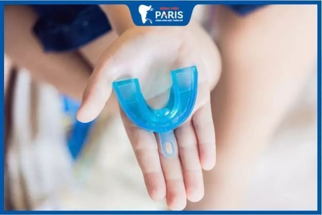 Niềng răng tháo lắp silicon