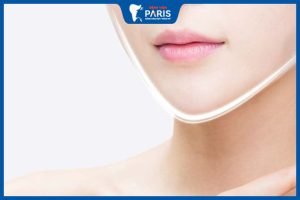 6 Tips chăm sóc sau phẫu thuật gọt hàm bạn không thể bỏ qua