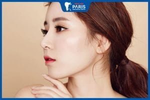 Độn cằm bao lâu thì lành – Những yếu tố quyết định trực tiếp