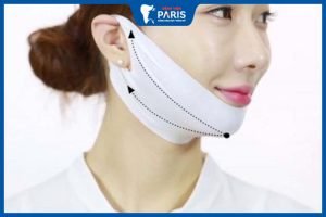 Độn cằm bao lâu thì tháo băng – Những lưu ý quan trọng