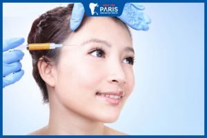 Độn thái dương bằng mỡ tự thân – Những điều quan trọng cần biết