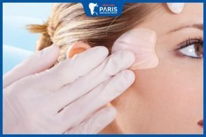 Độn thái dương bằng sụn nhân tạo và những thông tin bạn nên biết
