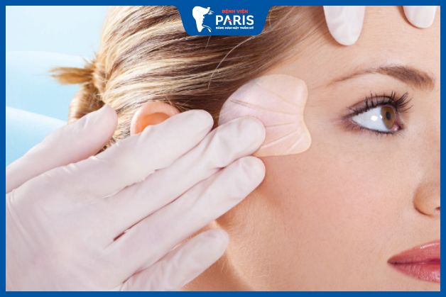 Độn thái dương bằng sụn nhân tạo có độ bền lâu nhất