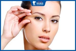 Độn thái dương sau bao lâu ổn định – Giải đáp từ bác sĩ thẩm mỹ