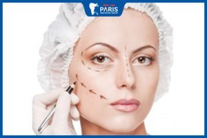 Hạ gò má có ảnh hưởng gì không – Các biến chứng có thể xảy ra