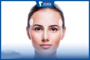 Lộ miếng độn thái dương: Nguyên nhân và cách khắc phục