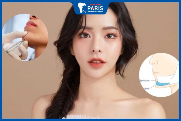 Nên độn cằm bằng sụn silicon hay tiêm filler