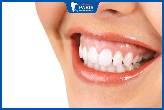 Phụ nữ răng ngắn cười hở lợi tướng số không tốt