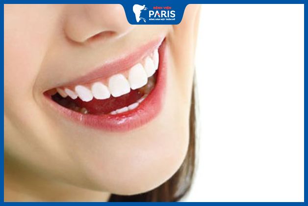 Hàm răng sau khi bọc sứ thẩm mỹ