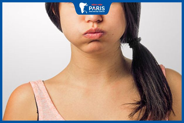Bài tập khắc phục má hóp nhẹ