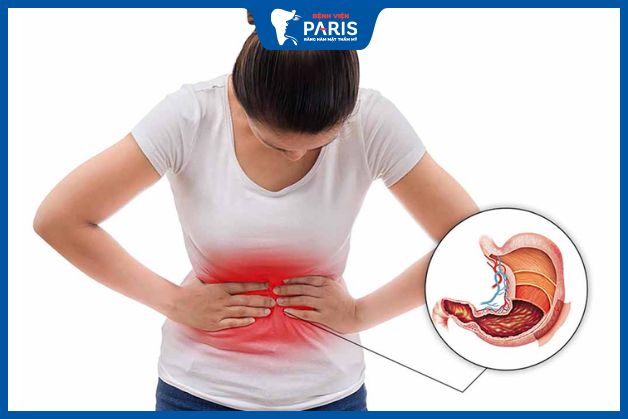 Người lệch hàm rất dễ mắc phải bệnh lý viêm dạ dày