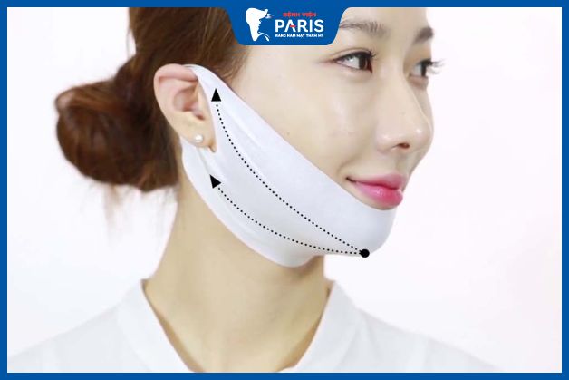 Chăm sóc sau khi độn cằm chữa hô đúng cách
