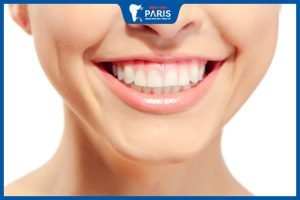 Chữa cười hở lợi có nguy hiểm không – Biến chứng có thể xảy ra
