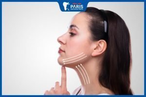 Độn cằm bị bao xơ: Nguyên nhân, các cấp độ và giải pháp