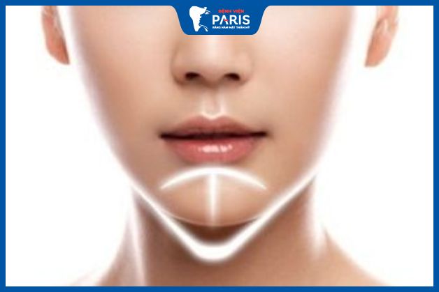 Hiện tượng sưng tấy gần như đã biến mất sau 7 ngày độn cằm