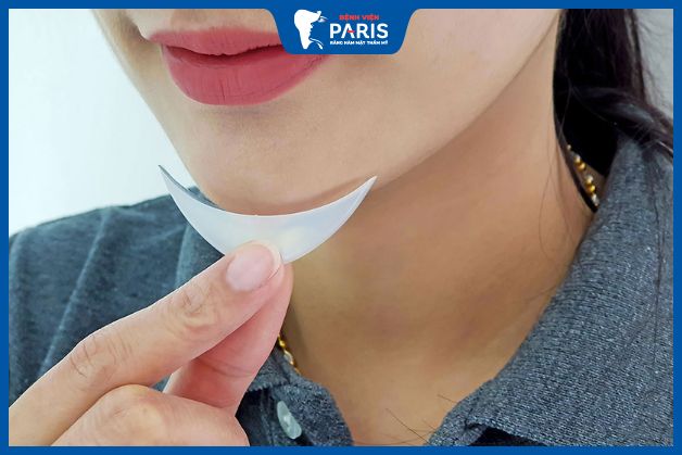 Phương pháp độn cằm sụn Surgiform