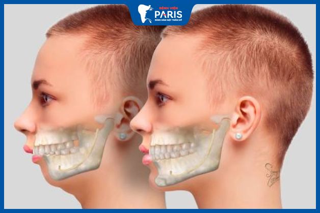 Giảm mức độ đau