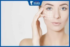 Hạ gò má có bị xệ mặt không? Chuyên gia thẩm mỹ tiết lộ 70% được cải thiện