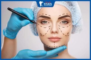 Bật mí những kinh nghiệm hạ gò má bạn nên biết