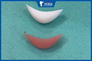 2 Loại miếng sụn độn cằm phổ biến – Cách chăm sóc sau độn cằm