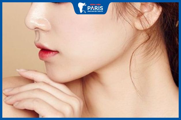 Độn cằm bằng sụn đem lại hiệu quả thẩm mỹ cao