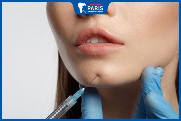 Tiêm filler độn cằm
